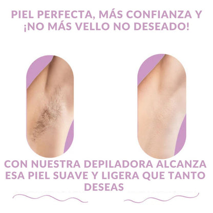 FlashBare® - MAQUINA DEPILADORA LASER IPL