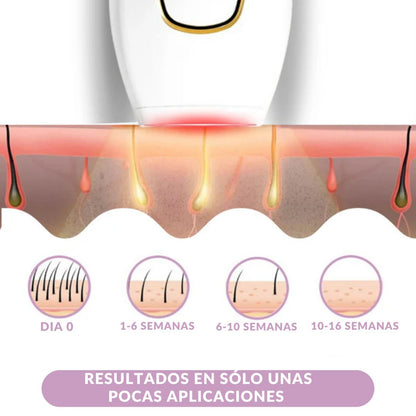 FlashBare® - MAQUINA DEPILADORA LASER IPL